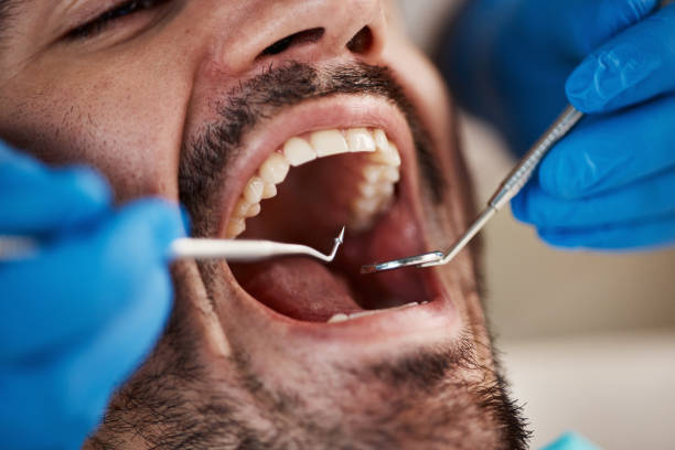 Best Holiday Emergency Dentist in Red Oak, NC